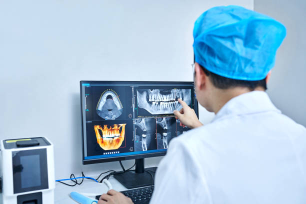 Best Emergency Wisdom Teeth Removal in Knightstown, IN