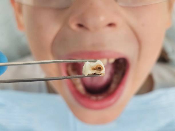 Best Emergency Gum Treatment in Knightstown, IN